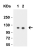 Figure 1 Western Blot Validation in Human PC-3 Cell Lysate
Loading: 15 &#956;g of lysates per lane.
Antibodies: Vinculin 7489 (Lane 1: 0.5 &#956;g/mL and Lane 2: 1 &#956;g/mL) , 1h incubation at RT in 5% NFDM/TBST.
Secondary: Goat anti-rabbit IgG HRP conjugate at 1:10000 dilution.