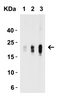 Figure 2 Western Blot Validation with Recombinant Protein
Loading: 30 ng of human IL-9 recombinant protein per lane.
Antibodies: IL-9, 7495 (Lane 1: 1 ug/mL, Lane 2: 2 ug/mL and Lane 3: 4 ug/mL) , 1h incubation at RT in 5% NFDM/TBST.
Secondary: Goat anti-rabbit IgG HRP conjugate at 1:10000 dilution.
Observed at around 22kD.