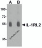 Western blot analysis of IL-1RL2 in human small intestine lysate with IL-1RL2 antibody at (A) 1 and (B) 2 &#956;g/ml.