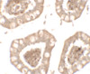 Immunohistochemistry of IL-1RL2 in human small intestine tissue with IL-1RL2 antibody at 5 ug/mL.