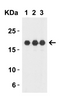 Figure 1 Western Blot Validation with Recombinant Protein
Loading: 30 ng of human IL-1F10 recombinant protein per lane.
Antibodies: IL-1F10 7503 (Lane 1: 1 &#956;g/mL, Lane 2: 2 &#956;g/mL and Lane 3: 4 &#956;g/mL) , 1h incubation at RT in 5% NFDM/TBST.
Secondary: Goat anti-rabbit IgG HRP conjugate at 1:10000 dilution.