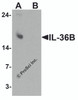 Western blot analysis of IL-36B in A549 cell lysate with IL-36B antibody at 1 &#956;g/ml in (A) the absence and (B) the presence of blocking peptide.