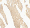 Immunohistochemistry of IL-36RN in rat small intestine tissue with IL-36RN antibody at 5 ug/mL.