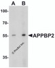 Western blot analysis of APPBP2 in human brain tissue lysate with APPBP2 antibody at (A) 0.5 and (B) 1 &#956;g/ml.