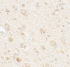 Immunohistochemistry of MAP1LC3A in human brain tissue with MAP1LC3A antibody at 5 ug/mL.
