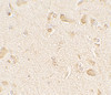 Immunohistochemistry of MAP1LC3C in human brain tissue with MAP1LC3C antibody at 5 ug/mL.