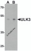 Western blot analysis of ULK3 in human brain tissue lysate with ULK3 antibody at (A) 0.5 and (B) 1 &#956;g/ml.