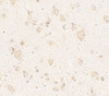 Immunohistochemistry of ULK4 in human brain tissue with ULK4 antibody at 5 ug/mL.