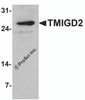 Western blot analysis of TMIGD2 in mouse small intestine tissue lysate with TMIGD2 antibody at 1 &#956;g/ml.