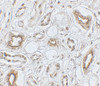 Immunohistochemistry of AQP2 in human kidney tissue with AQP2 antibody at 5 ug/mL.