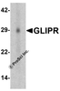 Western blot analysis of GLIPR1 in human small intestine tissue lysate with GLIPR1 antibody at 1 &#956;g/ml.