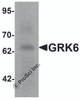 Western blot analysis of GRK6 in rat small intestine tissue lysate with GRK6 antibody at 1 &#956;g/ml.