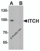Western blot analysis of ITCH in 3T3 cell lysate with ITCH antibody at 1 &#956;g/ml in (A) the absence and (B) the presence of blocking peptide.