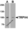 Western blot analysis of TRPV4 in (A) human testis tissue and (B) SK-N-SH cell lysate with TRPV4 antibody at 1 &#956;g/mL.