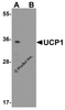 Western blot analysis of UCP1 in human brain tissue lysate with UCP1 antibody at 1 &#956;g/mL in (A) the absence and (B) the presence of blocking peptide.