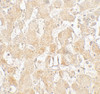 Immunohistochemistry of UCP1 in human liver tissue with UCP1 antibody at 2.5 ug/mL.