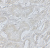 Immunohistochemistry of ARF6 in human kidney tissue with ARF6 antibody at 5 ug/mL.