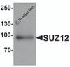 Western blot analysis of SUZ12 in human liver tissue lysate with SUZ12 antibody at 1 &#956;g/ml.