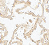 Immunohistochemistry of SUZ12 in human lung tissue with SUZ12 antibody at 5 ug/mL.
