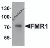 Western blot analysis of FMR1 in rat brain tissue lysate with FMR1 antibody at 1 &#956;g/ml.