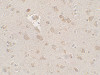 Immunohistochemistry of FMR1 in human brain tissue with FMR1 antibody at 2.5 ug/mL.