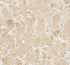 Immunohistochemistry of LAMTOR2 in human spleen tissue with LAMTOR2 antibody at 5 ug/mL.