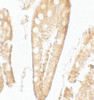 Immunohistochemistry of CFTR in human small intestine tissue with CFTR antibody at 5 ug/mL.