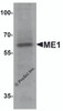Western blot analysis of ME1 in 293 cell lysate with ME1 antibody at 1 &#956;g/ml.