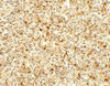 Immunohistochemistry of ME2 in human spleen tissue with ME2 antibody at 5 ug/mL.