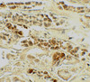 Immunohistochemistry of TERF2 in human kidney tissue with TERF2 antibody at 5 ug/mL.