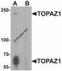Western blot analysis of TOPAZ1 in human testis tissue lysate with TOPAZ1 antibody at 1 &#956;g/ml in (A) the absence and (B) the presence of blocking peptide.