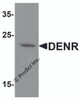 Western blot analysis of DENR in human brain tissue lysate with DENR antibody at 1 &#956;g/ml.