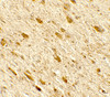 Immunohistochemistry of DENR in rat brain tissue with DENR antibody at 5 ug/mL.