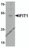 Western blot analysis of IFIT1 in rat small intestine tissue lysate with IFIT1 antibody at 1 &#956;g/ml.