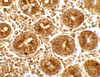 Immunohistochemistry of IFIT1 in human small intestine tissue with IFIT1 antibody at 5 ug/mL.