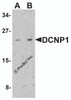 Western blot analysis of DCNP1 in mouse skeletal muscle tissue lysate with DCNP1 antibody at (A) 1 and (B) 2 &#956;g/ml.