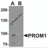 Western blot analysis of PROM1 in Jurkat cell lysate with PROM1 antibody at 1 &#956;g/ml in (A) the absence and (B) the presence of blocking peptide.