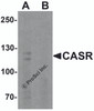 Western blot analysis of CASR in EL4 cell lysate with CASR antibody at 1 &#956;g/ml in (A) the absence and (B) the presence of blocking peptide.