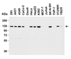 Figure 2 Western Blot Validation in Human, Mouse and Rat Cell Lines
Loading: 15 ug of lysates per lane.
Antibodies: Vinculin 7809 (1 ug/mL) , 1h incubation at RT in 5% NFDM/TBST.
Secondary: Goat anti-rabbit IgG HRP conjugate at 1:10000 dilution.