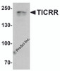 Western blot analysis of TICRR in human small intestine tissue lysate with TICRR antibody at 1 &#956;g/ml.