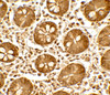 Immunohistochemistry of TICRR in human small intestine tissue with TICRR antibody at 5 ug/mL.