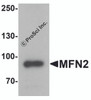 Western blot analysis of MFN2 in human brain tissue lysate with MFN2 antibody at 1 &#956;g/ml.