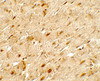 Immunohistochemistry of ANGPTL3 in rat heart tissue with ANGPTL3 antibody at 5 ug/mL.