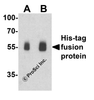 Western blot analysis of a His-tag-containing recombinant protein with His-tag antibody at (A) 0.25 and (B) 0.5 &#956;g/ml.