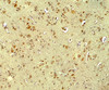 Immunohistochemistry of PARK2 in human brain tissue with PARK2 antibody at 5 ug/ml.