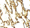 Immunohistochemistry of ATG4C in human lung tissue with ATG4C antibody at 5 ug/ml.