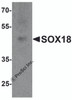 Western blot analysis of SOX18 in 3T3 cell lysate with SOX18 antibody at 1 &#956;g/ml.