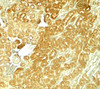 Immunohistochemistry of SMURF1 in rat kidney tissue with SMURF1 antibody at 5 ug/ml.