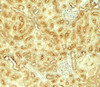 Immunohistochemistry of VEZT in rat kidney tissue with VEZT antibody at 5 ug/ml.