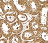 Immunohistochemistry of AKAP4 in human testis tissue with AKAP4 antibody at 5 ug/ml.